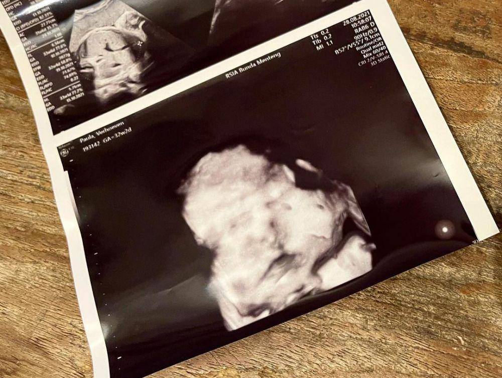 maternity Paula Verhoeven (Instagram.com/bapau.jr)