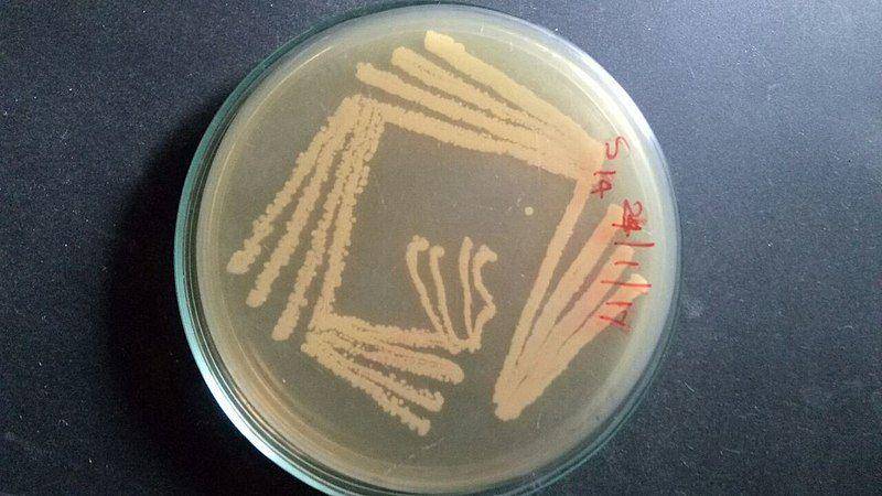 ilustrasi bakteri Kytococcus sedentarius (commons.m.wikimedia.org/Meenakshi nandhini)