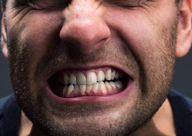 ilustrasi bruksism (hawaiifamilydental.com/)
