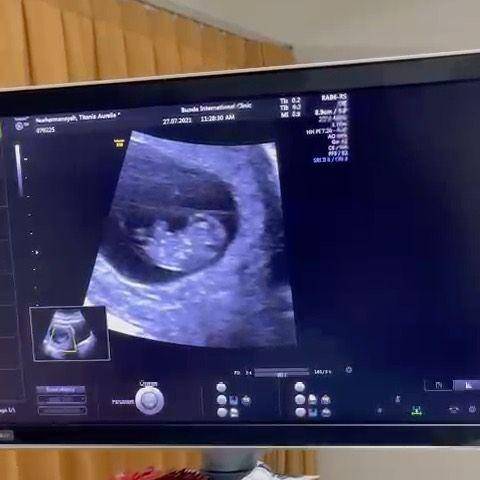 baby bump Aurel Hermansyah (Instagram.com/aurelie.hermansyah)