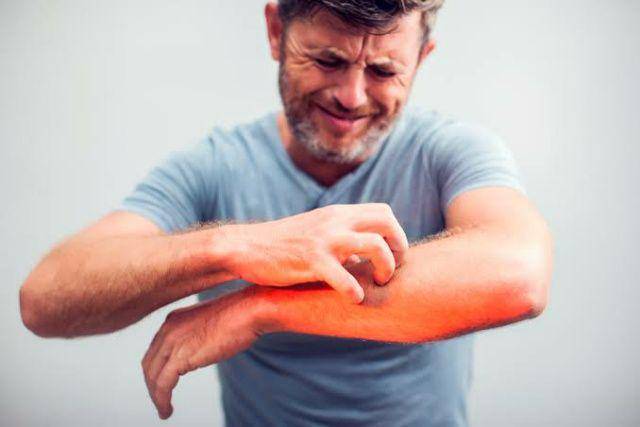 ilustrasi penderita Morgellons (coloradoallergy.com)