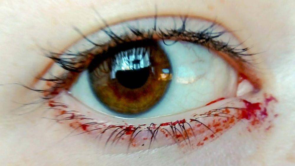 ilustrasi air mata darah atau hemolacria (healthline.com)