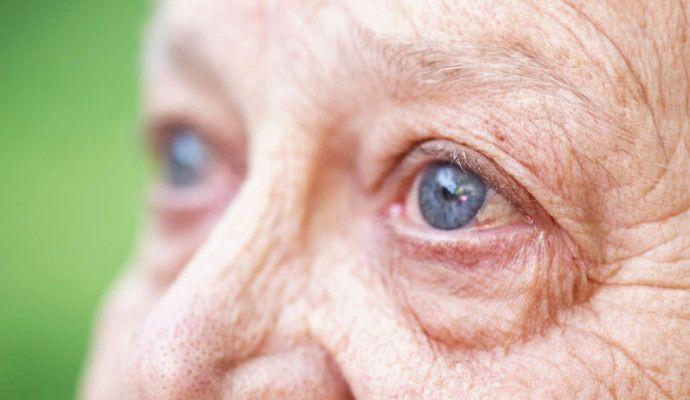 Mengenal AMD, Penyebab Kebutaan Paling Umum Ketiga di Dunia