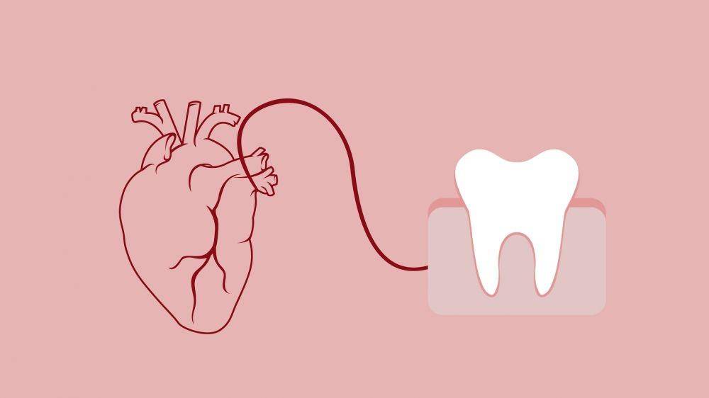 ilustrasi korelasi gigi dan jantung (healthblog.uofmhealth.org)