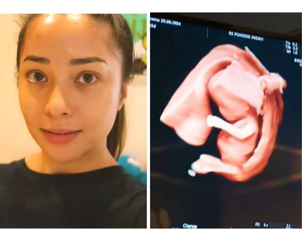 Nikita Willy USG (YouTube.com/Nikita Willy Official)