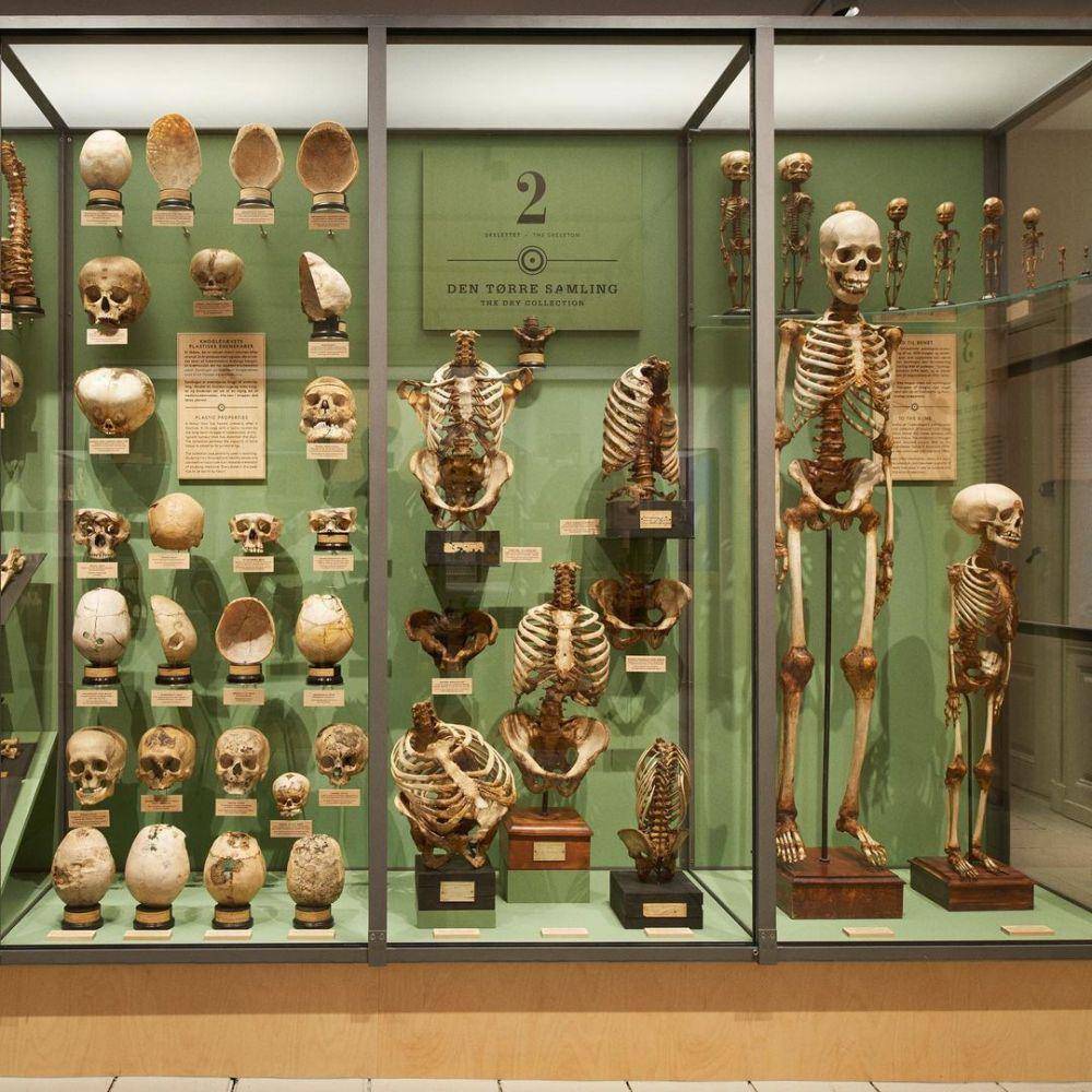Salah satu koleksi di Medical Museion, Copenhagen (instagram.com/medicinskmuseion)