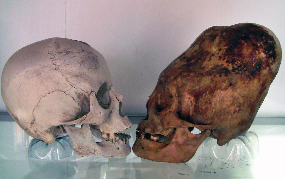 potret tengkorak manusia normal dengan tengkorak Paracas (latinamericanstudies.org)
