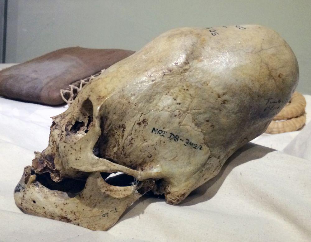 potret tulang tengkorak orang Paracas (latinamericanstudies.org)