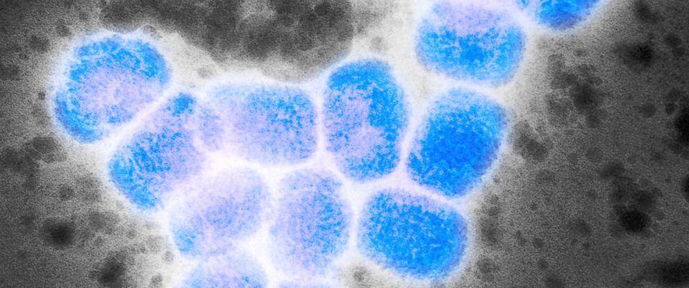 ilustrasi sampel virus cacar (abcnews.com)