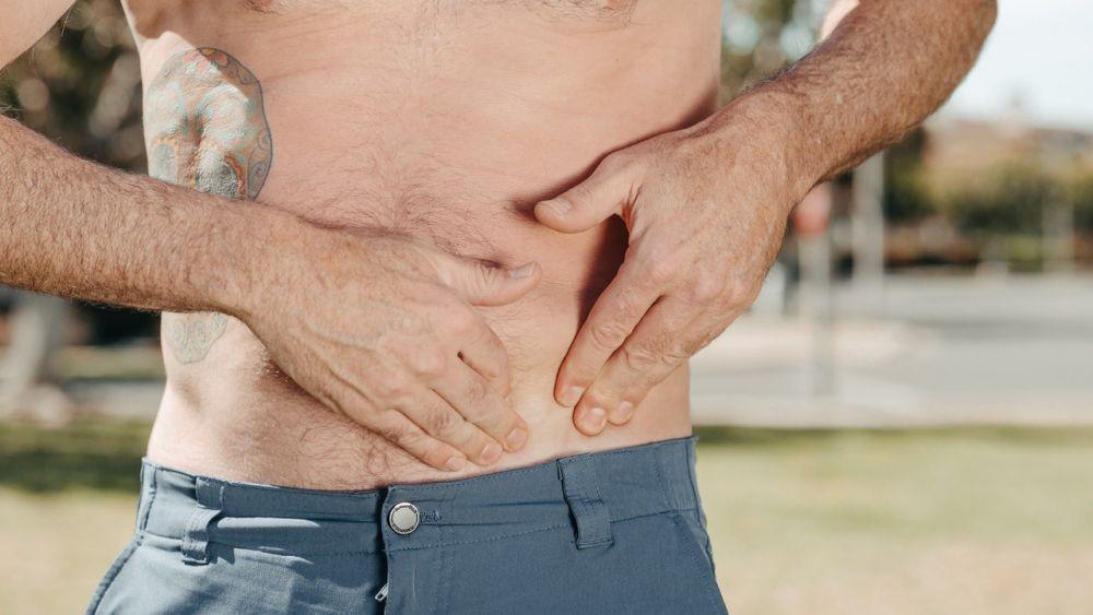 Hernia Umbilikalis: Penyebab, Gejala, Komplikasi, dan Pengobatan