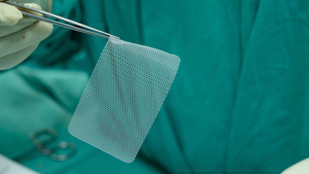 Mesh atau jaring sintetis yang dipakai dalam operasi hernia umbilikalis. (michiganherniasurgery.com)