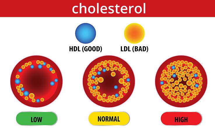 ilustrasi kadar kolesterol (healthnavigator.org.nz)