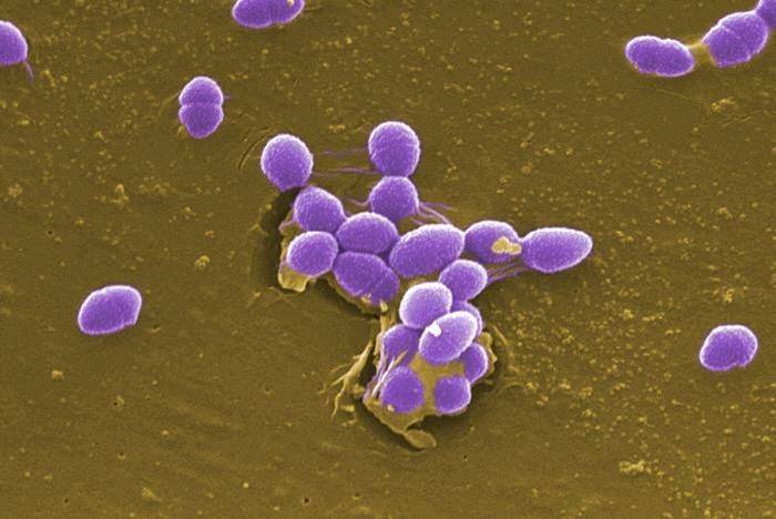 ilustrasi bakteri Enterococcus faecalis (outbreaknewstoday.com)