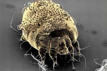 ilustrasi tungau Sarcoptes scabiei (webmd.com)