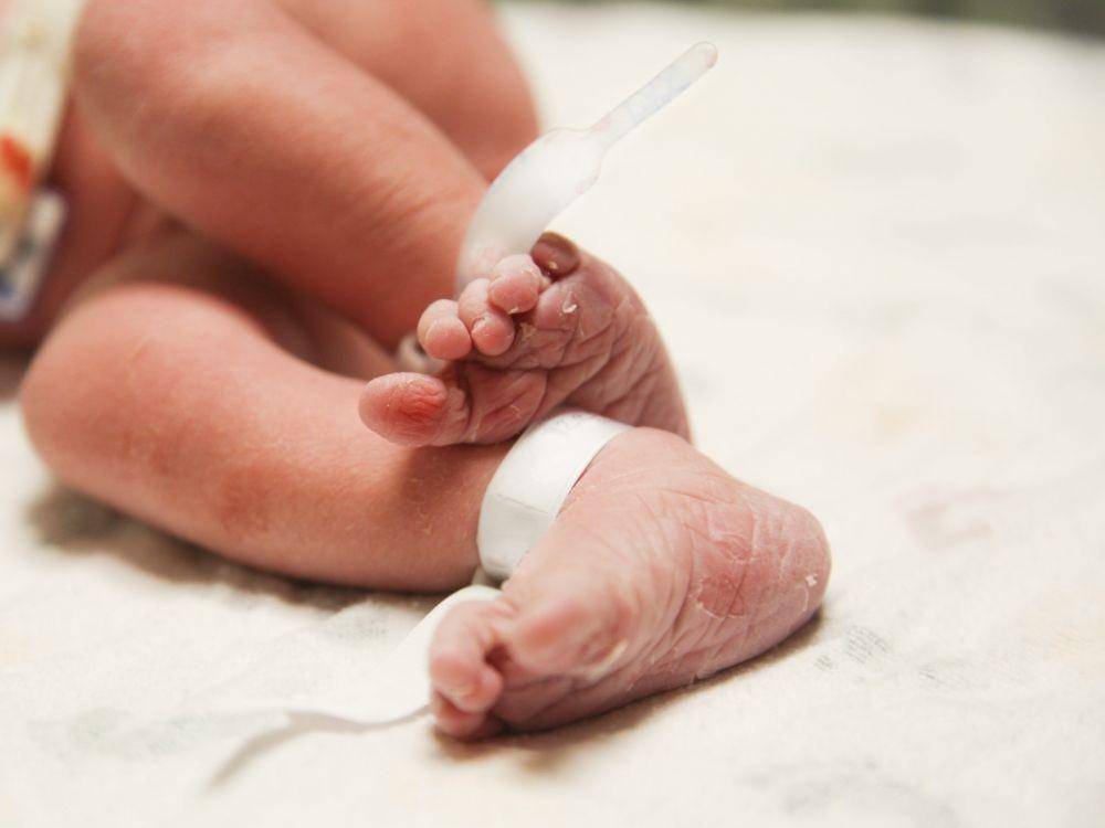 ilustrasi bayi dengan kernikterus (birthinjuryguide.org)