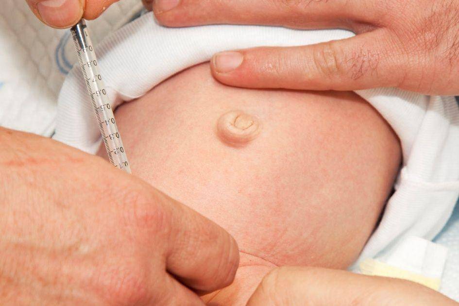 ilustrasi sunat pada bayi (health.clevelandclinic.org)