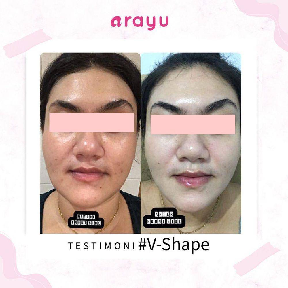 Arayu Clinic (instagram.com/arayuclinic)