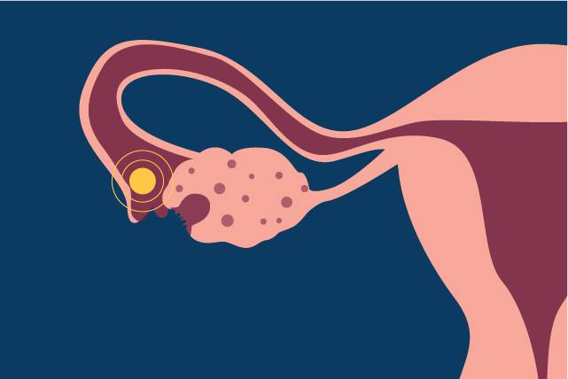 ilustrasi ovulasi (oviahealth.com)