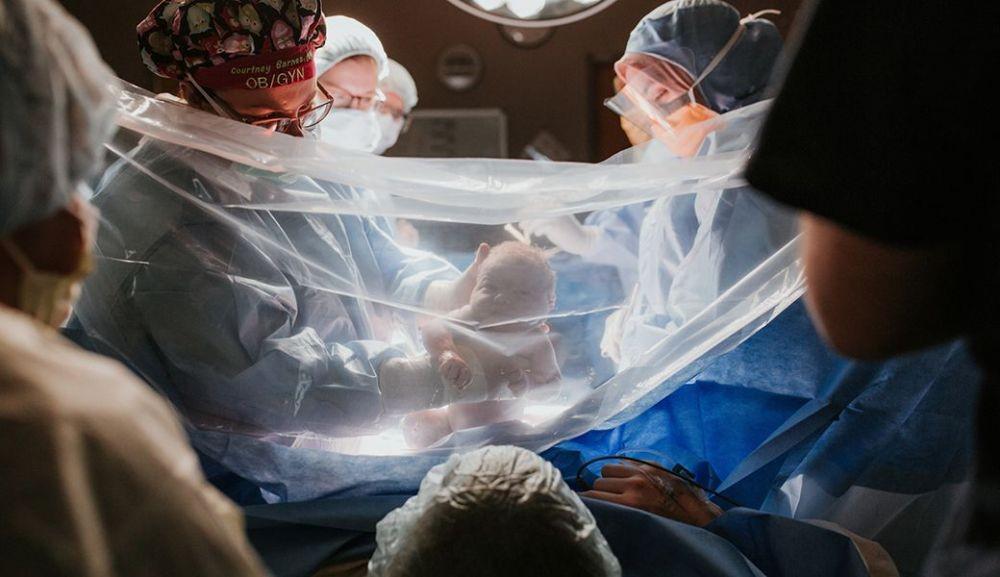 Tim Dokter RSUD Panglima Sebaya Berhasil Tangani Bayi Kembar Tiga