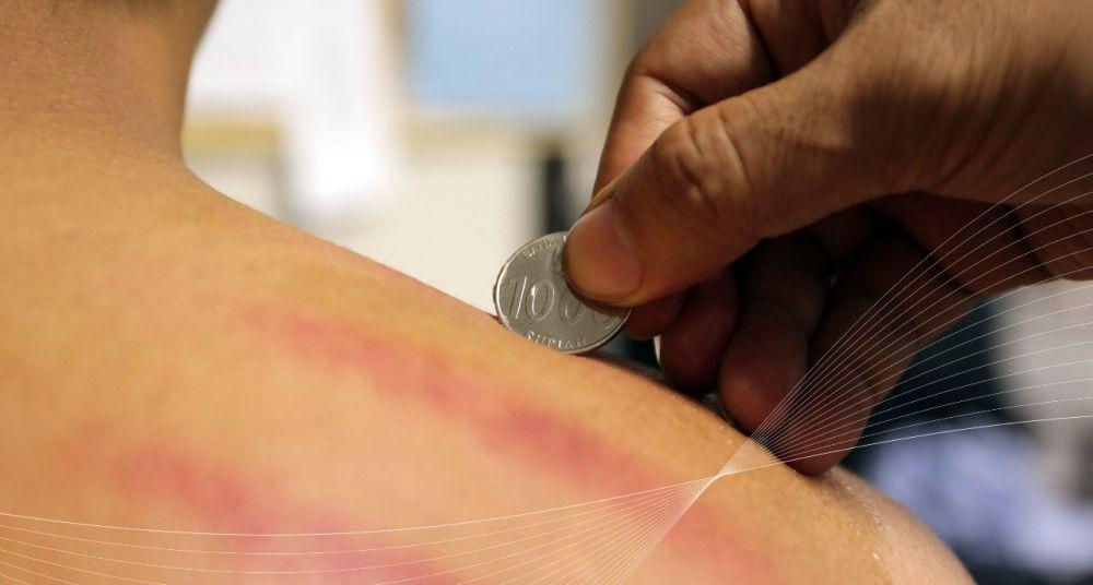 6 Kebiasaan Simpel Ini Bertentangan dengan Medis, Kamu Pernah Lakukan?