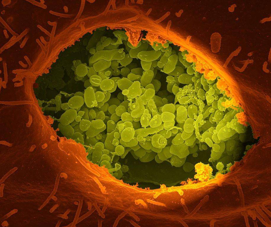 Coxiella burnetii, bakteri penyebab demam Q yang umum menginfeksi hewan ternak. (commons.wikimedia.org/National Institutes of Health)