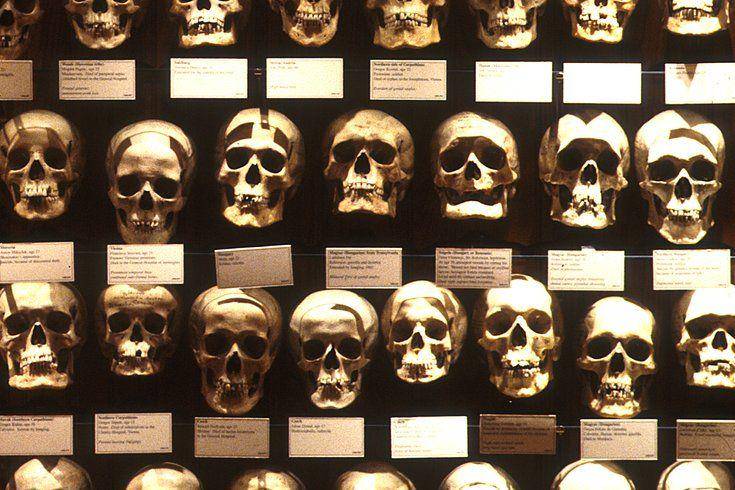 Mutter Museum, Pennsylvania (phillyvoice.com)