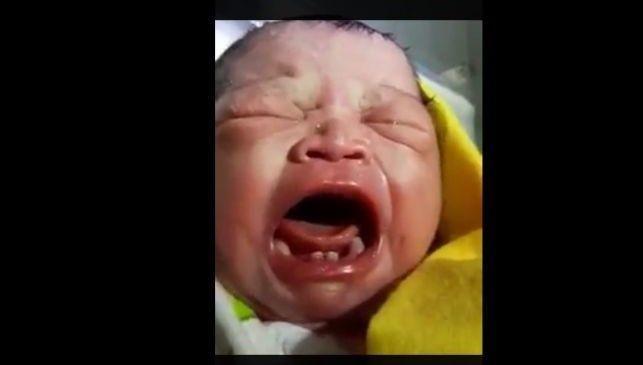 Ajaib! Bayi di Labura Lahir dengan Sudah Tumbuh Gigi