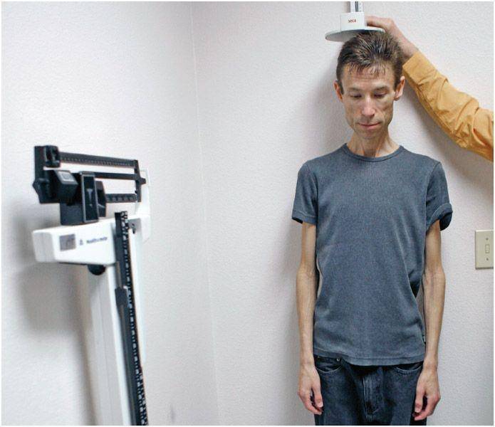 ilustrasi diagnosis anoreksia nervosa oleh dokter (reference.jrank.org)