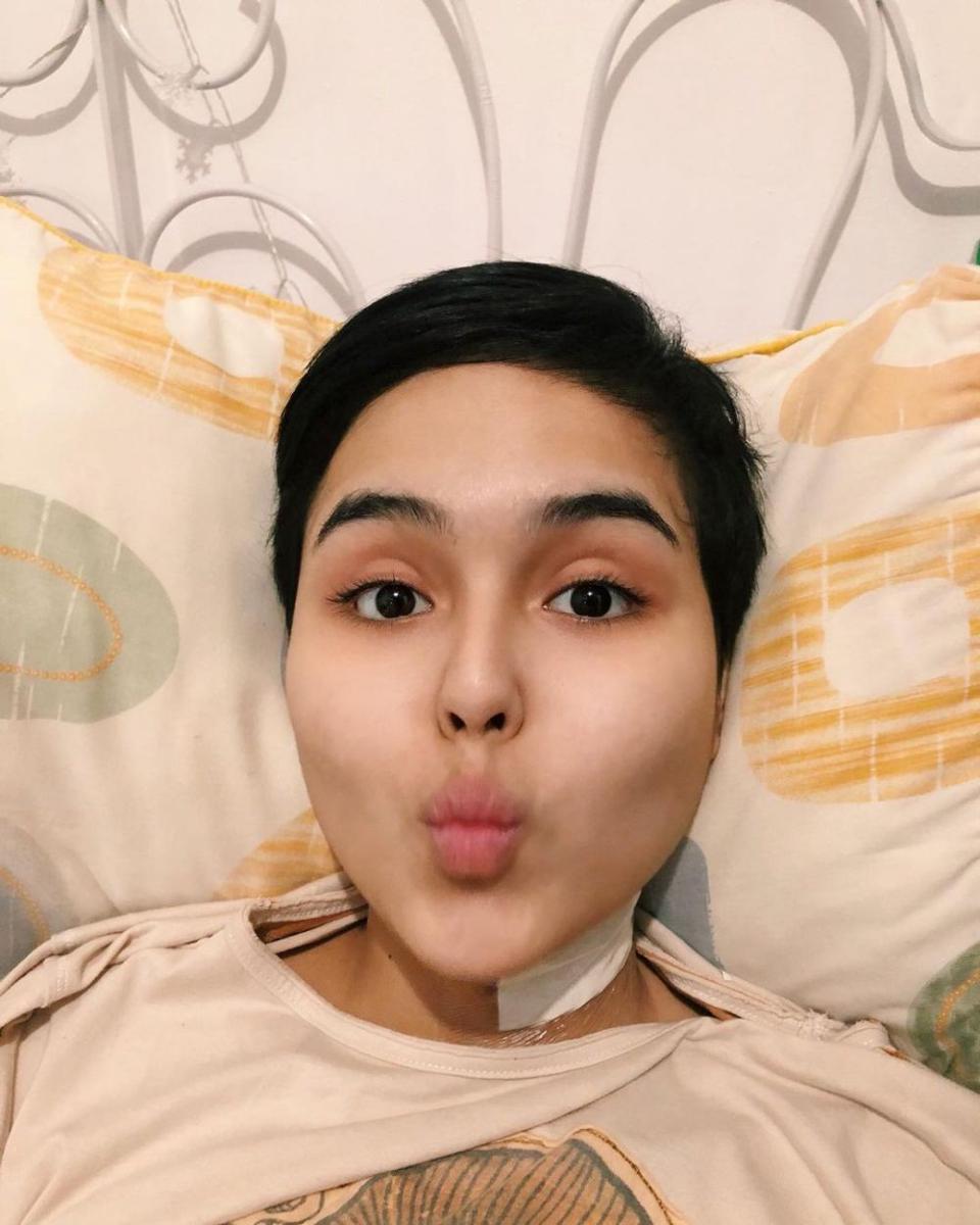 10 Potret Perjuangan Laura Anna Sebelum Meninggal Dunia