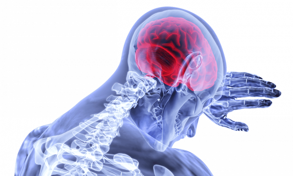 ilustrasi stroke (pixabay.com/VSRao)