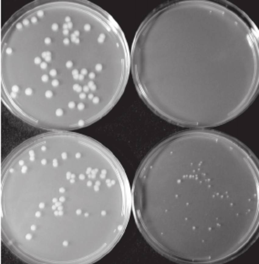 ilustrasi B. anthracis strain Ames (researchgate.net/Andrei P Pomerantsev)