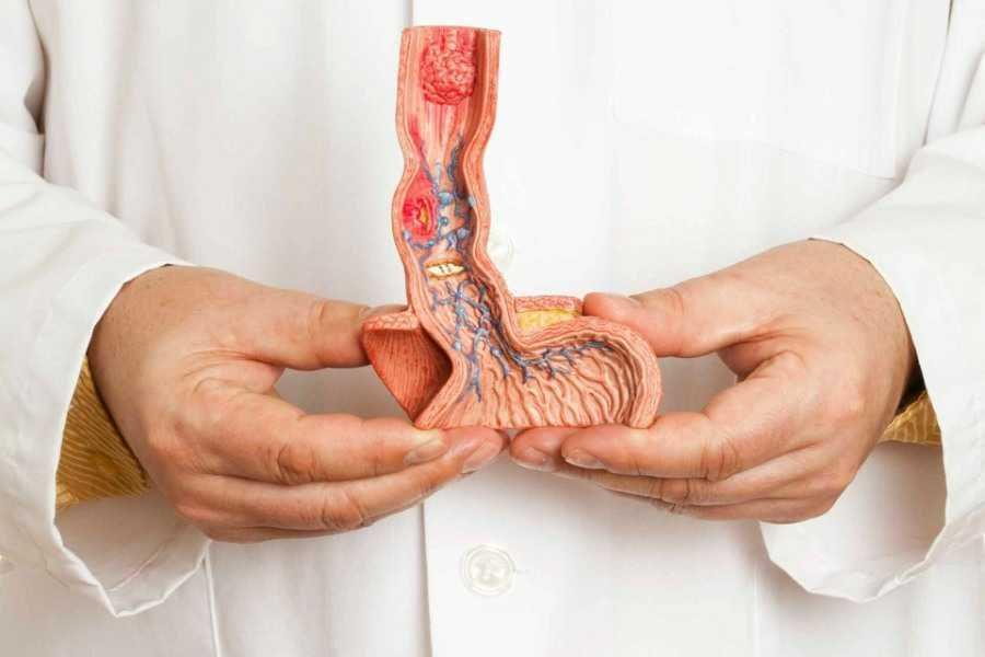 Kanker Penis: Penyebab, Gejala, Jenis, Pengobatan, dan Prognosis