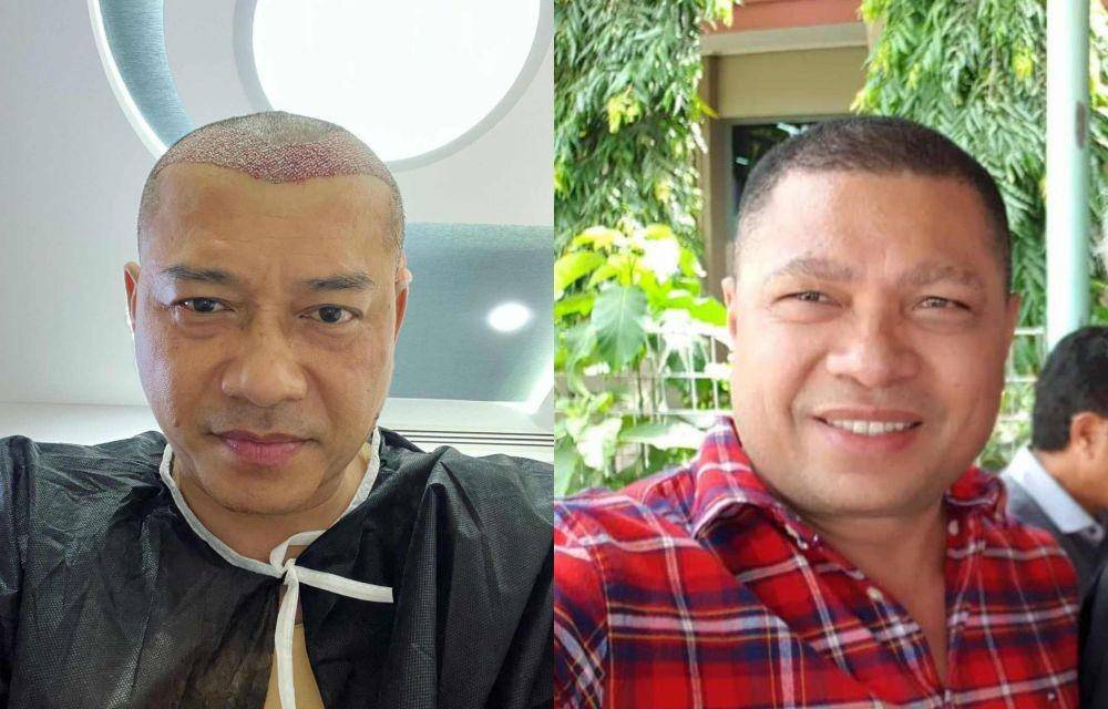 Anang Hermansyah gaya rambut baru (Instagram.com/ananghijau/ | Instagram.com/raullemos06/)