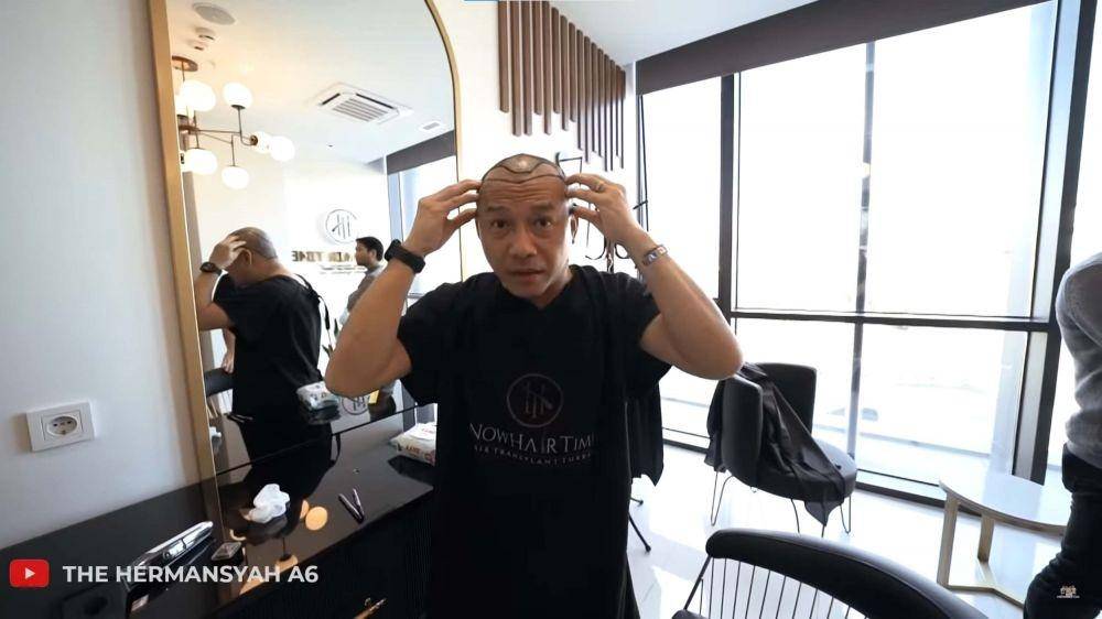 Anang Hermansyah gaya rambut baru (YouTuber.com/The Hermansyah A6/)