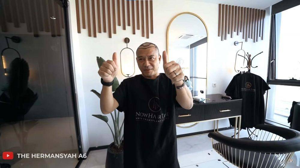 Anang Hermansyah gaya rambut baru (YouTuber.com/The Hermansyah A6/)