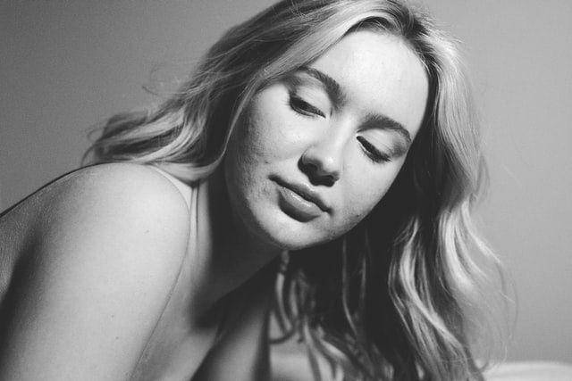 gambar perempuan dengan wajah berjerawat (unsplash.com/Matt Moloney)