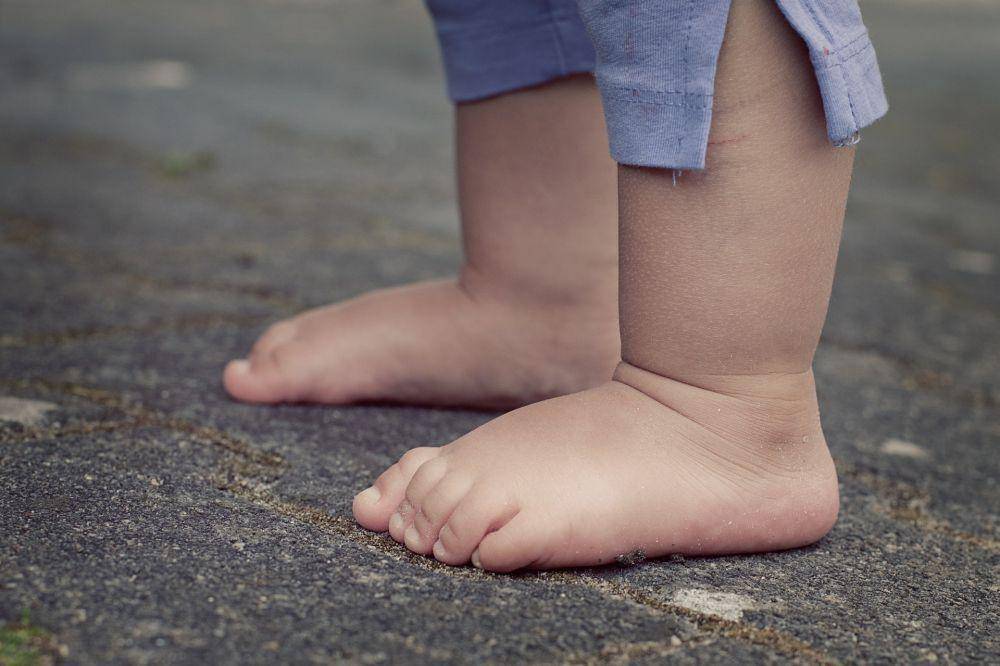 ilustrasi kaki (pixabay.com/Esi Grünhagen)