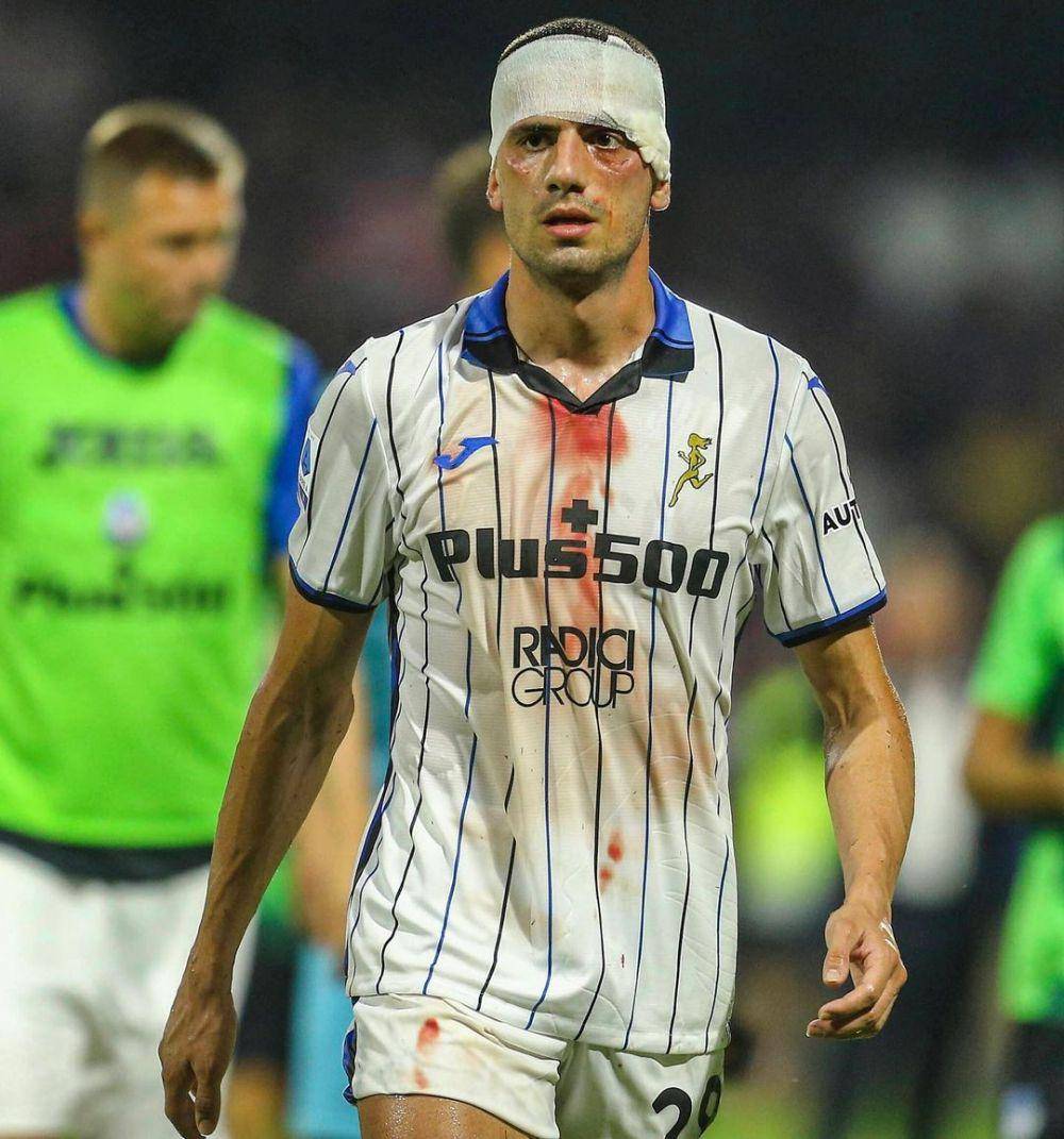 Merih Demiral tampil berdarah-darah bersama Atalanta. (instagram.com/merihdemiral)