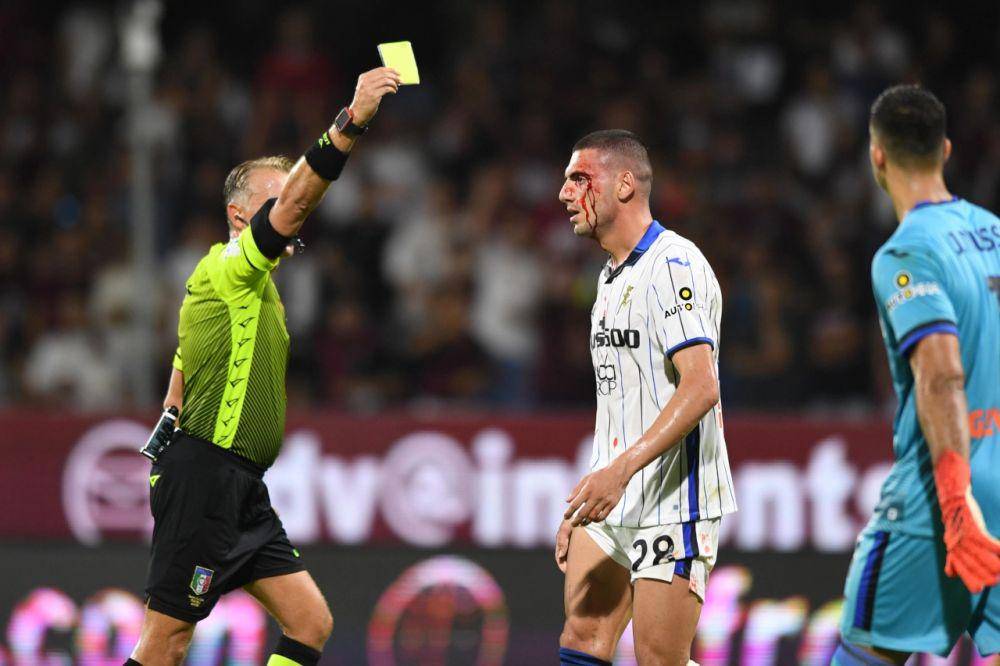 Merih Demiral diganjar kartu kuning saat tampil berdarah-darah untuk Atalanta. (football-italia.net)