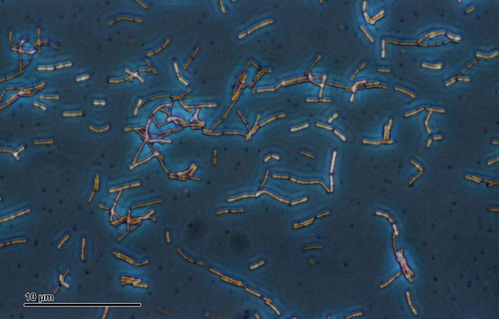 5 Manfaat Lactobacillus acidophilus bagi Tubuh