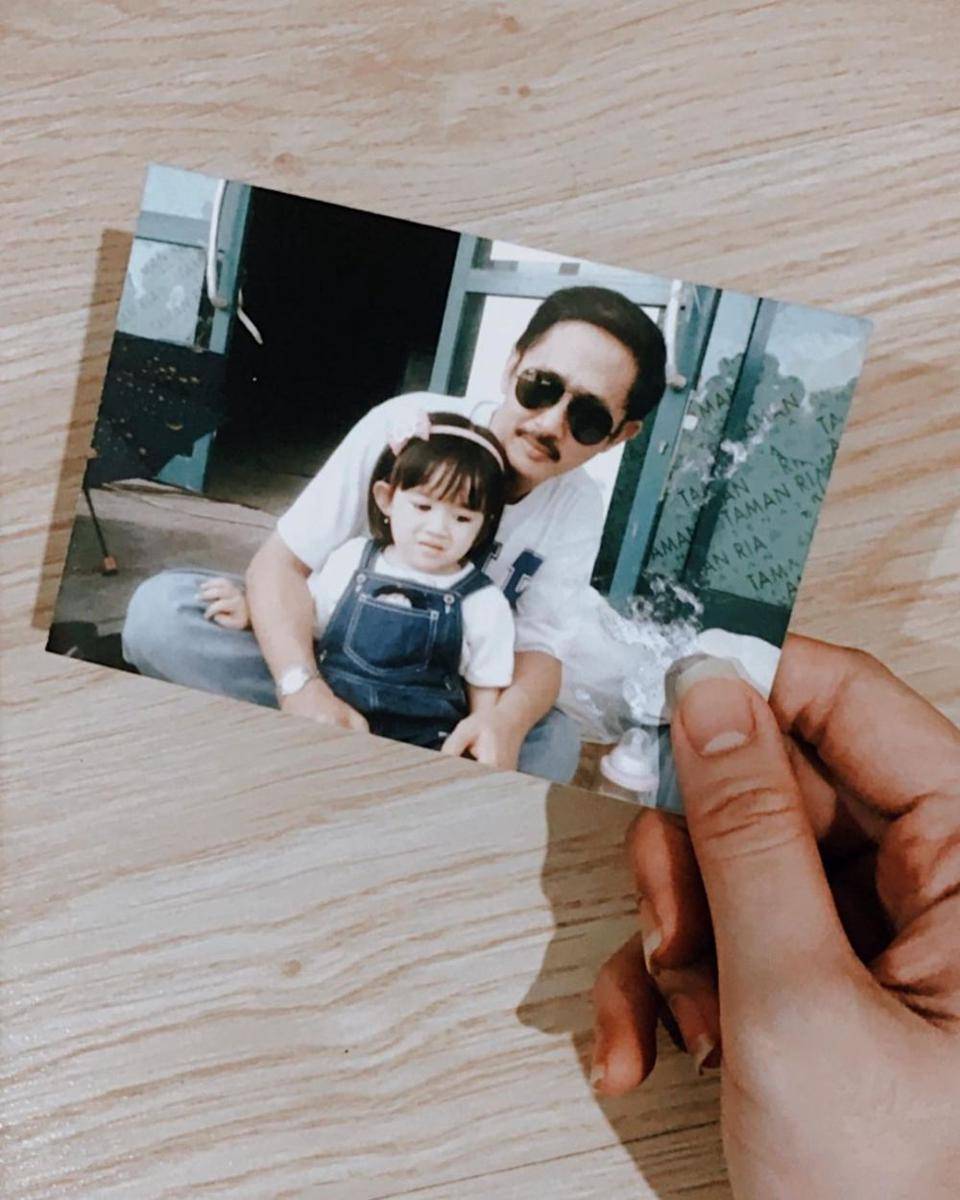 potret masa kecil Febby Rastanty (instagram.com/febbyrastanty)