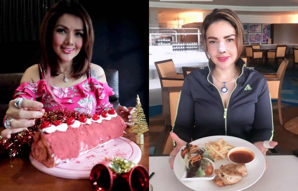 Operasi Lagi, 10 Potret Barbie Kumalasari dengan Hidung Masih Diperban