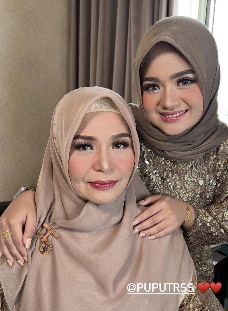Puput, adik Teuku Ryan (instagram.com/kakaalfarisi)