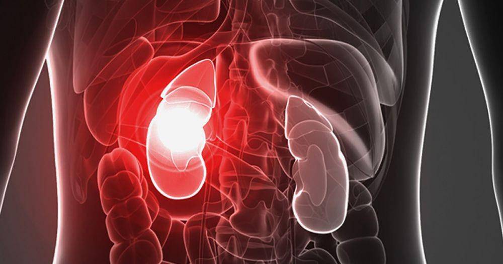 ilustrasi gagal ginjal (kidney.org)