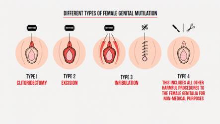 ilustrasi tipe-tipe sunat perempuan (uksaysnomore.org)