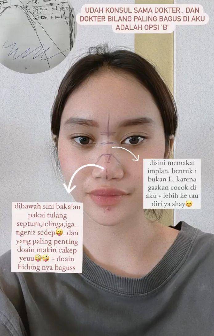 Foto oplas Permesta Dhyaz (Instagram.com/permestadhyaz)