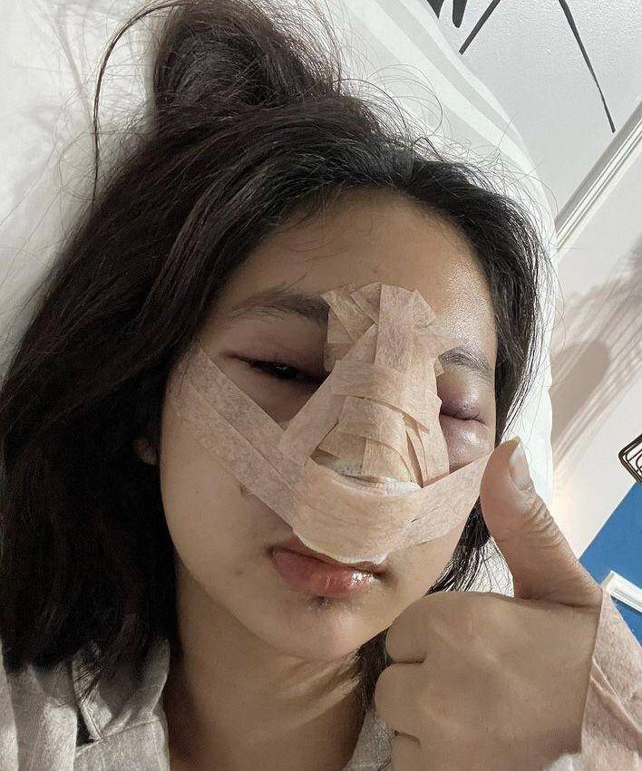 Foto oplas Permesta Dhyaz (Instagram.com/permestadhyaz)