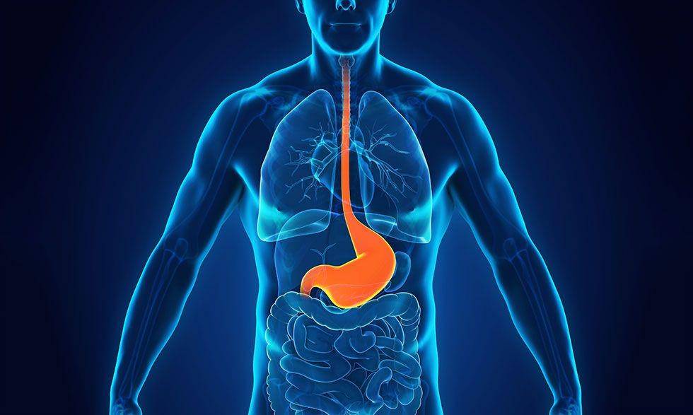 ilustrasi GERD (magazine.medlineplus.gov)