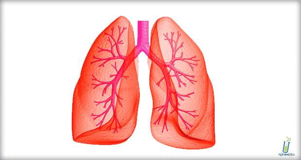 ilustrasi asidosis pernapasan (nurseslabs.com)