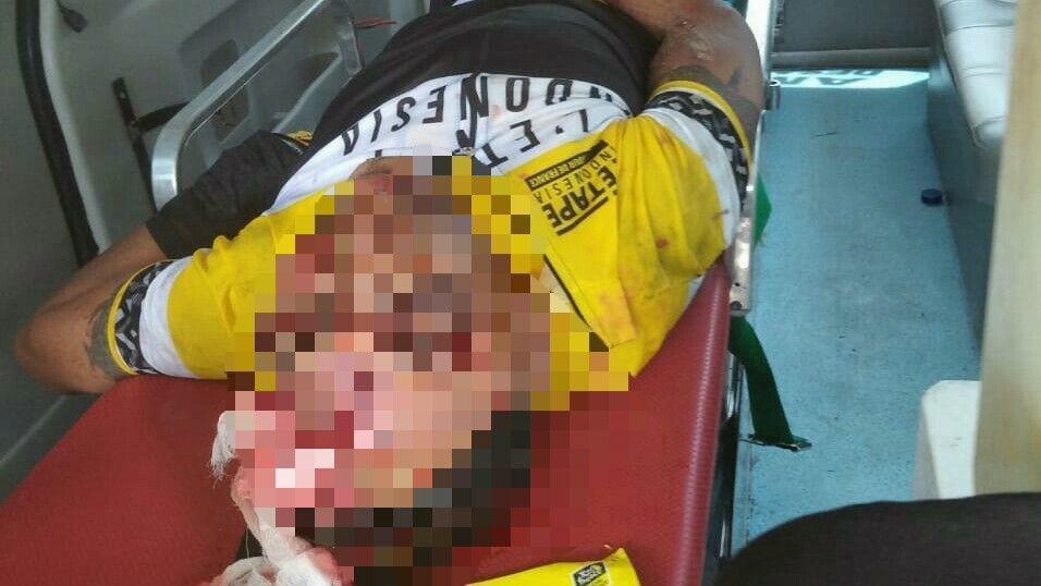 Satu Peserta L'Etape Indonesia Kecelakaan, Alami Luka Robek di Kepala